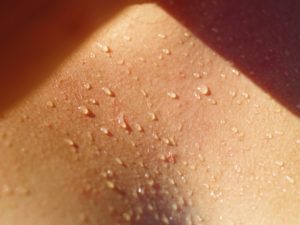 Sweat on a body- a physical symptom of anxiety